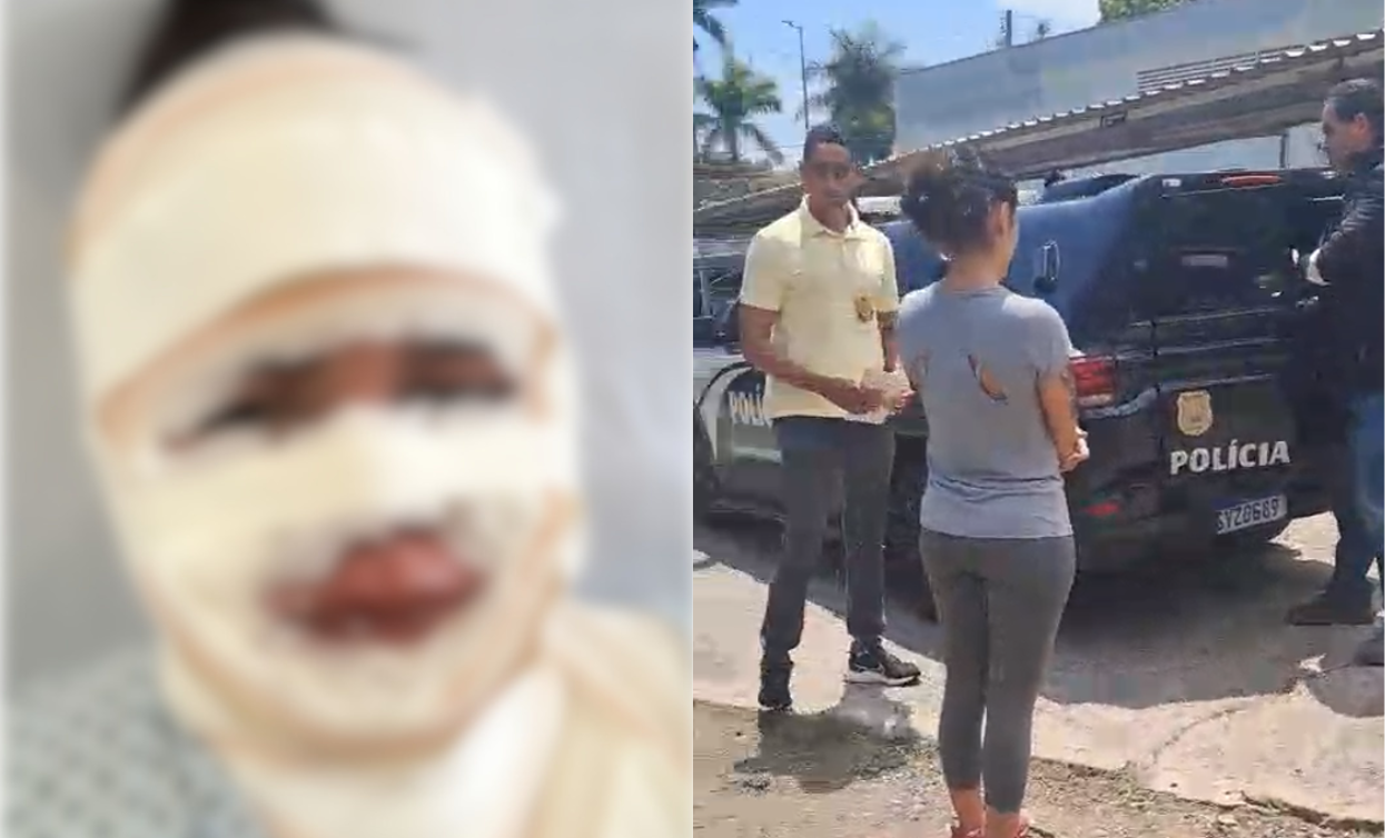 Fisioterapeuta é presa suspeita de jogar água quente no rosto de namorada do ex-companheiro em Belo Horizonte