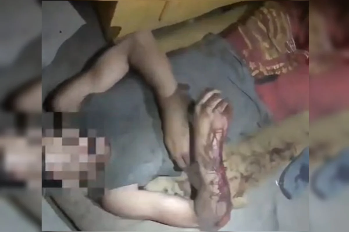 Imagem da matéria: Homem desmaia após ser espancado no Entorno e é socorrido pelos bombeiros