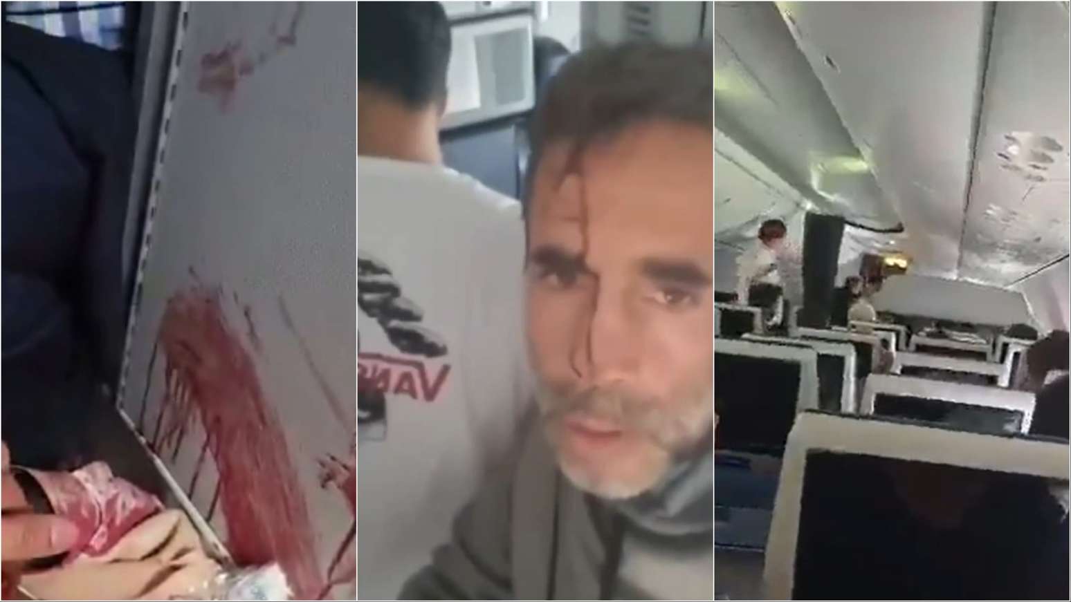Imagens mostram ataque a faca de copiloto contra o piloto em avi&atilde;o