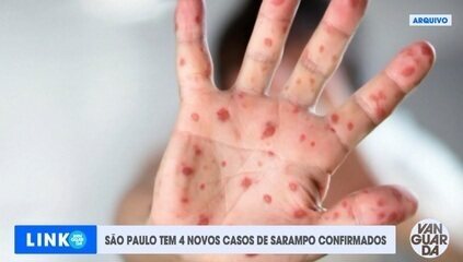 São Paulo tem 4 novos casos de sarampo confirmados